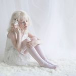 beleza-albina-10
