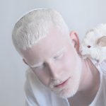 beleza-albina-7