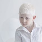 beleza-albina-9
