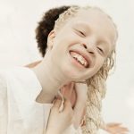 irmas-albinas (10)