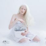 beleza-albina (10)