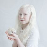 beleza-albina (2)