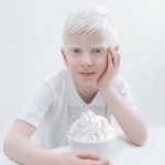 beleza-albina (6)