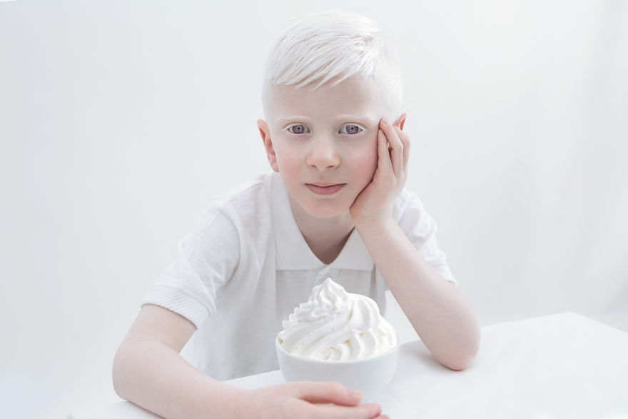 beleza-albina (6)