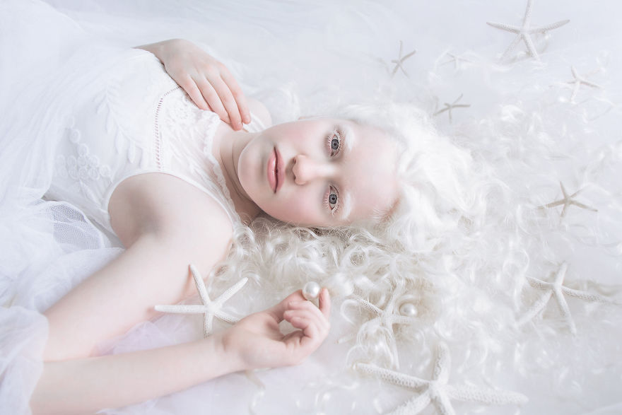 beleza-albina (7)